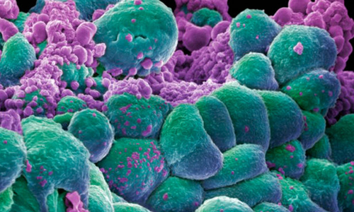 Cancer Therapy مجلة نقطة العلمية